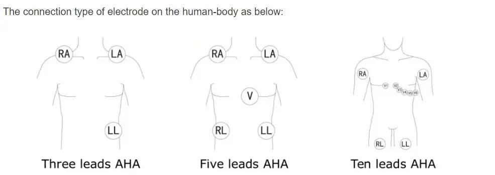 5-odprowadzeniowe przewody EKG do philips digitrak plus 24-godzinny holter 3100A, 5-odprowadzeniowy, Snap